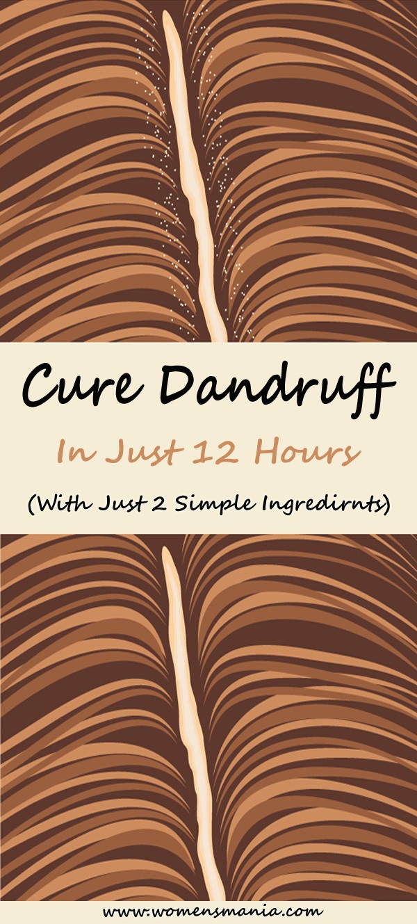 How To Cure Dandruff Overnight