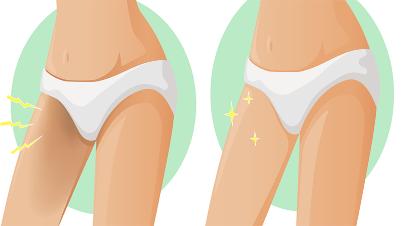 how to get rid of dark thighs at home