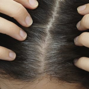 10 Simple and Best Home Remedies For Grey Hair