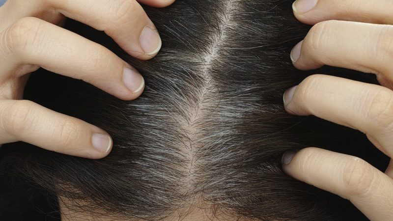 10 Simple and Best Home Remedies For Grey Hair