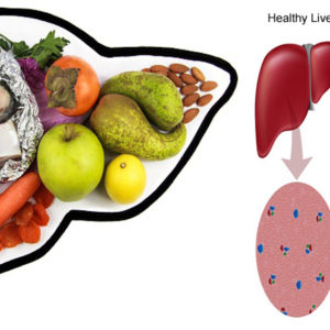 10 Best Tips To Prevent Fatty Liver: Diet and Lifestyle Tips